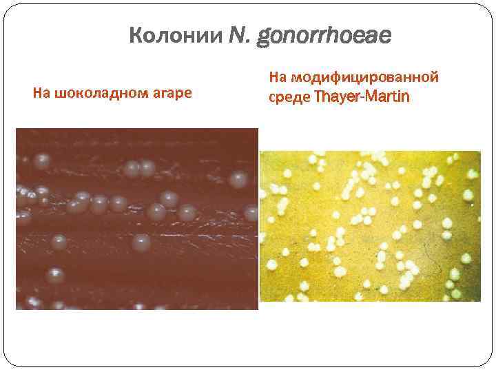 Колонии N. gonorrhoeae На шоколадном агаре На модифицированной среде Thayer-Martin 
