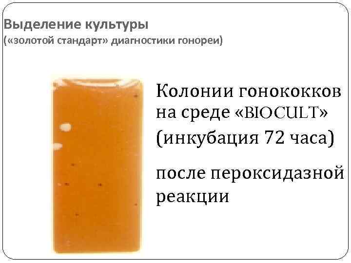 Выделение культуры ( «золотой стандарт» диагностики гонореи) Колонии гонококков на среде «BIOCULT» (инкубация 72