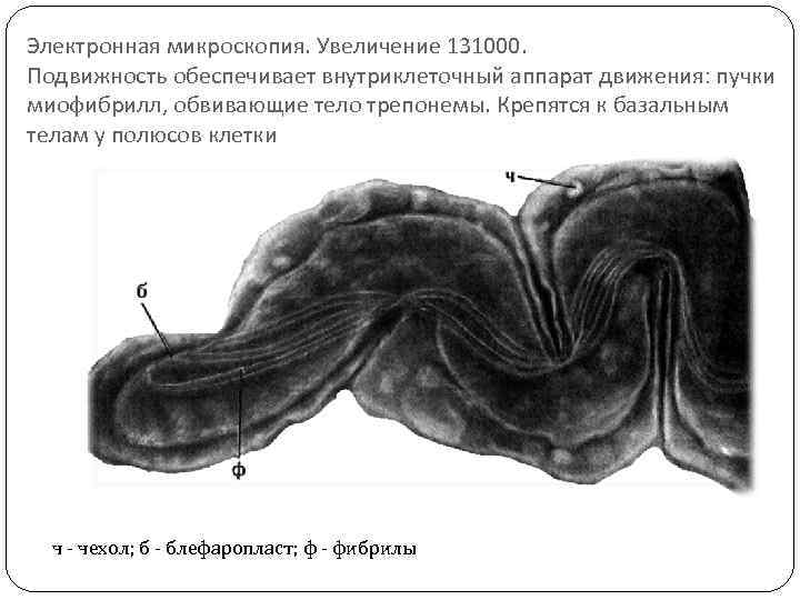 Электронная микроскопия. Увеличение 131000. Подвижность обеспечивает внутриклеточный аппарат движения: пучки миофибрилл, обвивающие тело трепонемы.