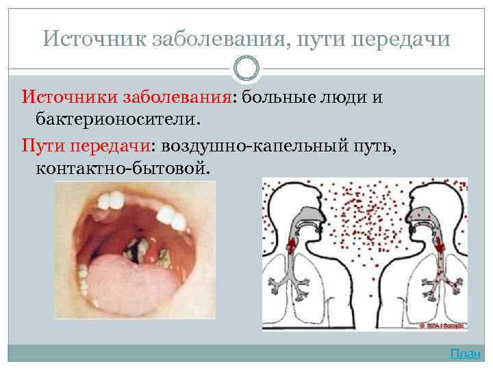 Источник заболевания, пути передачи Источники заболевания: больные люди и бактерионосители. Пути передачи: воздушно-капельный путь,