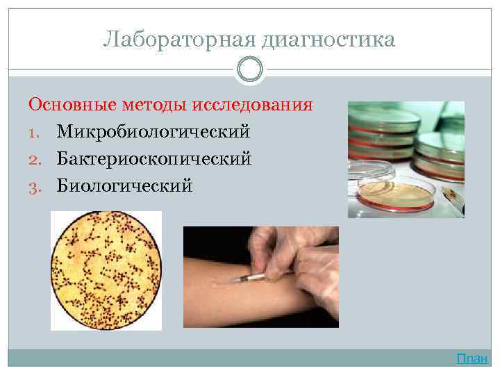 Лабораторная диагностика Основные методы исследования 1. Микробиологический 2. Бактериоскопический 3. Биологический План 