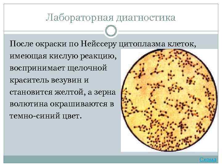 Лабораторная диагностика После окраски по Нейссеру цитоплазма клеток, имеющая кислую реакцию, воспринимает щелочной краситель