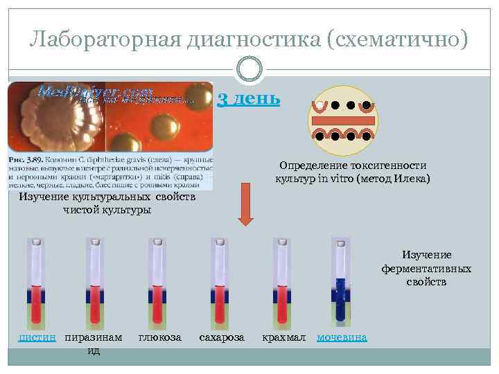 Лабораторная диагностика (схематично) 3 день Определение токсигенности культур in vitro (метод Илека) Изучение культуральных
