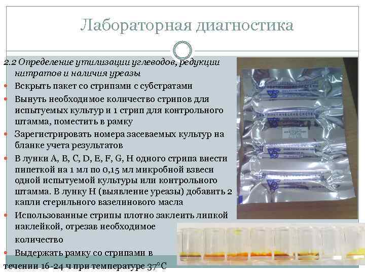 Лабораторная диагностика 2. 2 Определение утилизации углеводов, редукции нитратов и наличия уреазы Вскрыть пакет