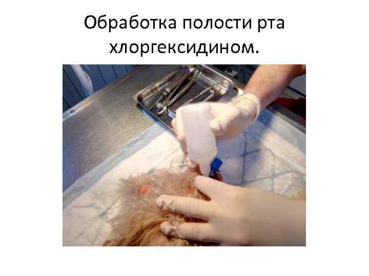 Обработка полости рта хлоргексидином. 