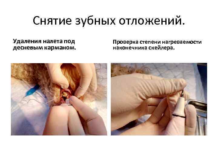Снятие зубных отложений. Удаления налета под десневым карманом. Проверка степени нагреваемости наконечника скейлера. 