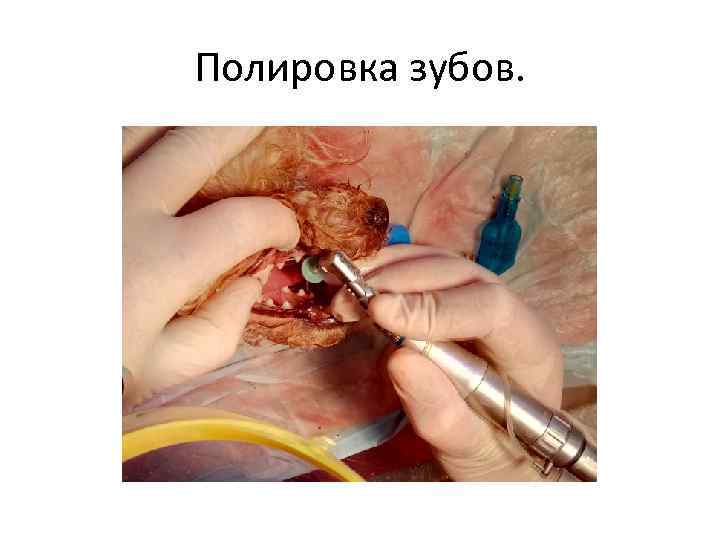 Полировка зубов. 