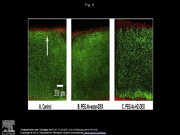 Fig. 4 Osteoarthritis and Cartilage 2016 24, 71 -81 DOI: (10. 1016/j. joca. 2015.