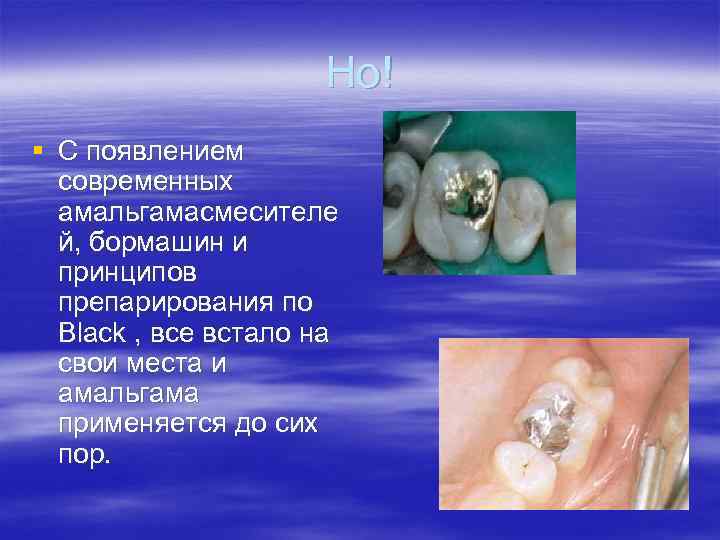 Но! § С появлением современных амальгамасмесителе й, бормашин и принципов препарирования по Black ,