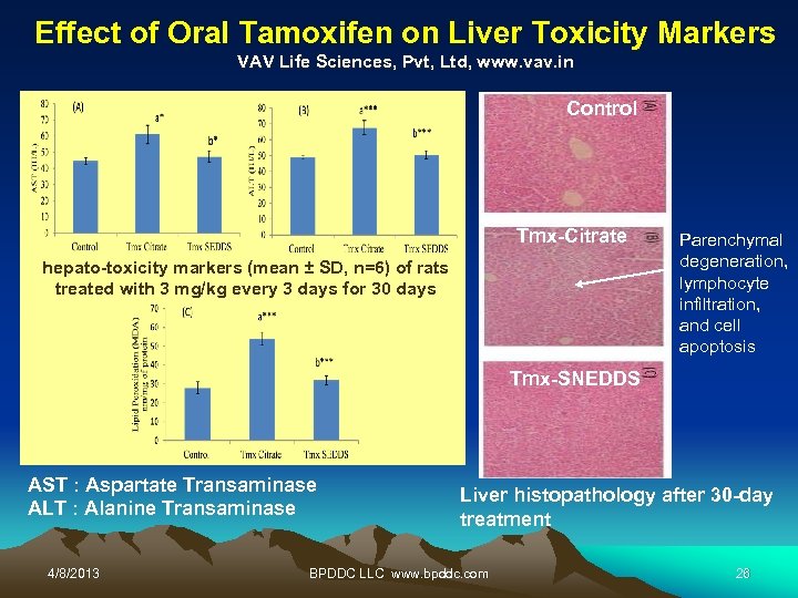 Effect of Oral Tamoxifen on Liver Toxicity Markers VAV Life Sciences, Pvt, Ltd, www.