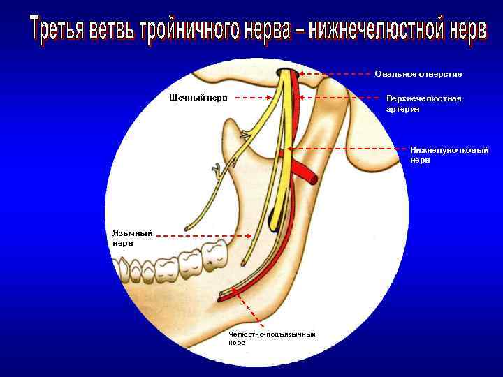 Овальное отверстие Щечный нерв Верхнечелюстная артерия Нижнелуночковый нерв Язычный нерв Челюстно-подъязычный нерв 