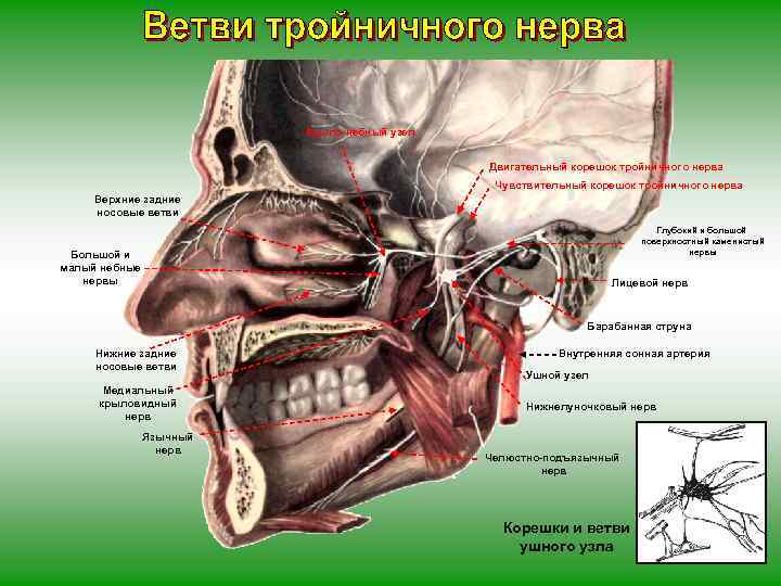 Крыло-небный узел Двигательный корешок тройничного нерва Чувствительный корешок тройничного нерва Верхние задние носовые ветви