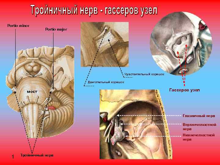 Portio minor Portio major Чувствительный корешок Двигательный корешок мост Гассеров узел Глазничный нерв Верхнечелюстной