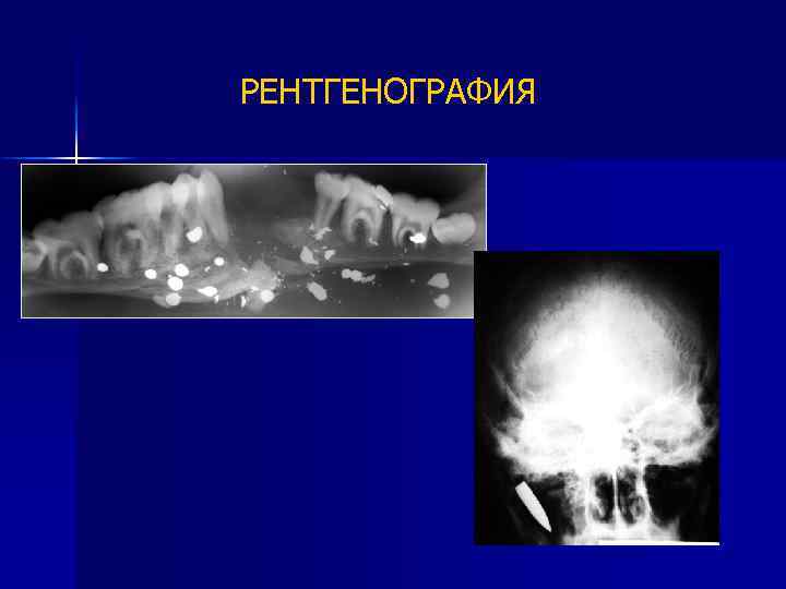 РЕНТГЕНОГРАФИЯ 