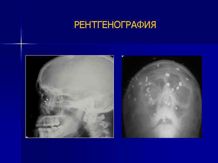 РЕНТГЕНОГРАФИЯ 