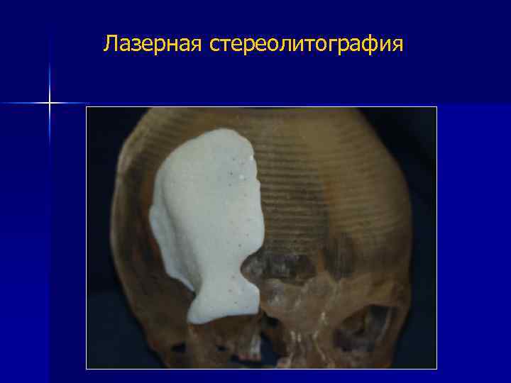 Лазерная стереолитография 