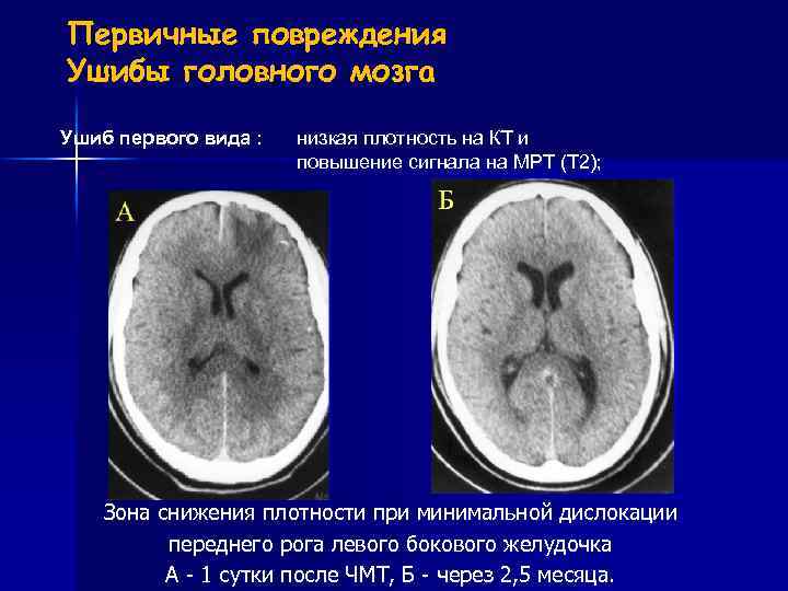 Ушиб головы карта вызова