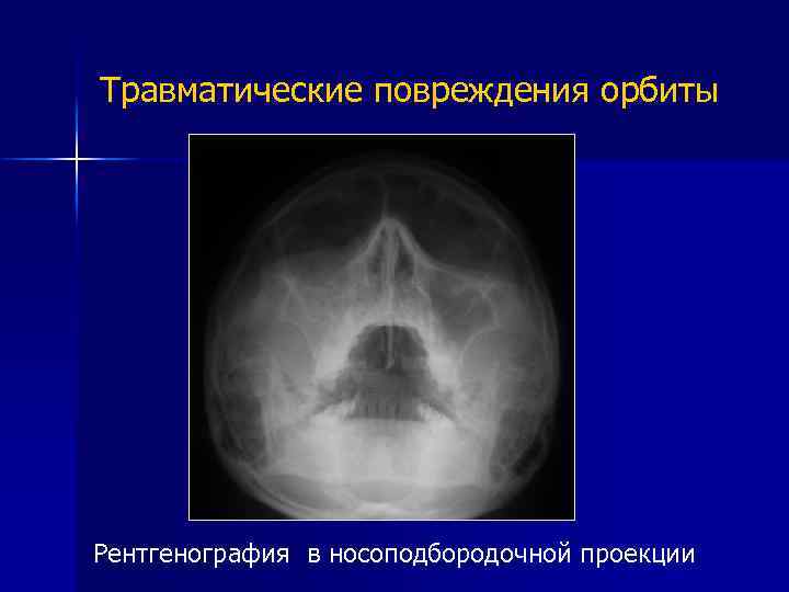 Проекции рентгена