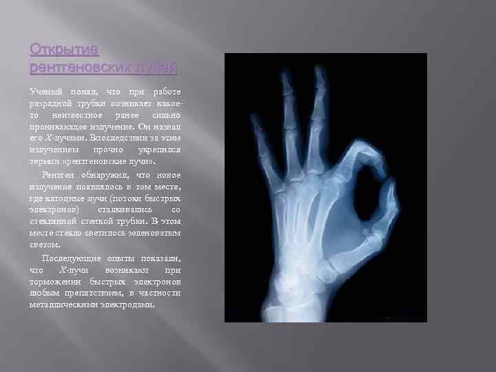 Открытие рентгеновских лучей Ученый понял, что при работе разрядной трубки возникает какоето неизвестное ранее
