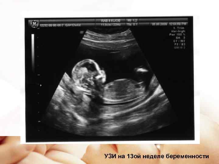 Фото плода в 12 недель беременности на узи