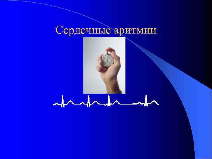 Сердечные аритмии 