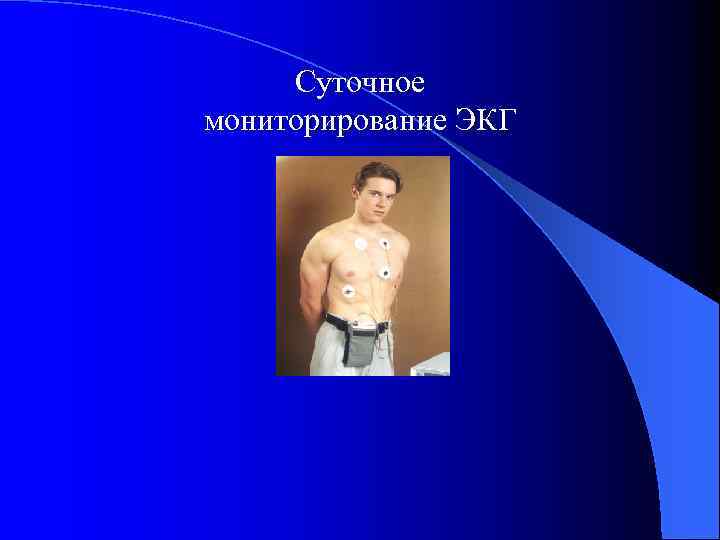Суточное мониторирование ЭКГ 