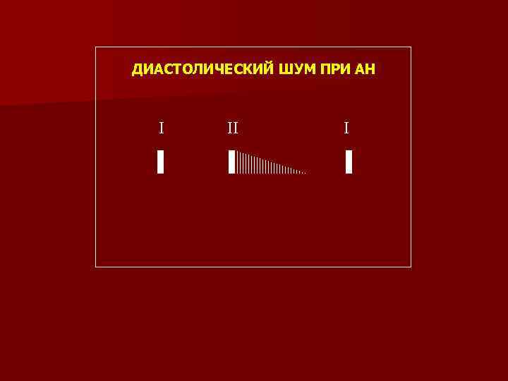 ДИАСТОЛИЧЕСКИЙ ШУМ ПРИ АН I II I 