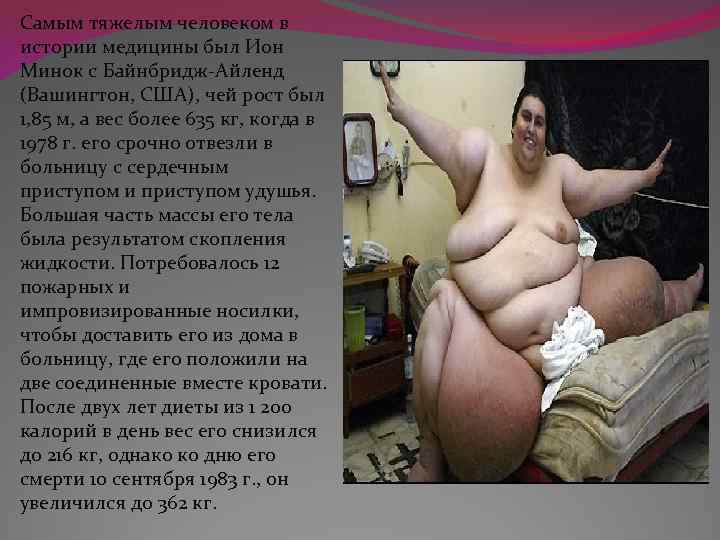 Самым тяжелым человеком в истории медицины был Ион Минок с Байнбридж-Айленд (Вашингтон, США), чей
