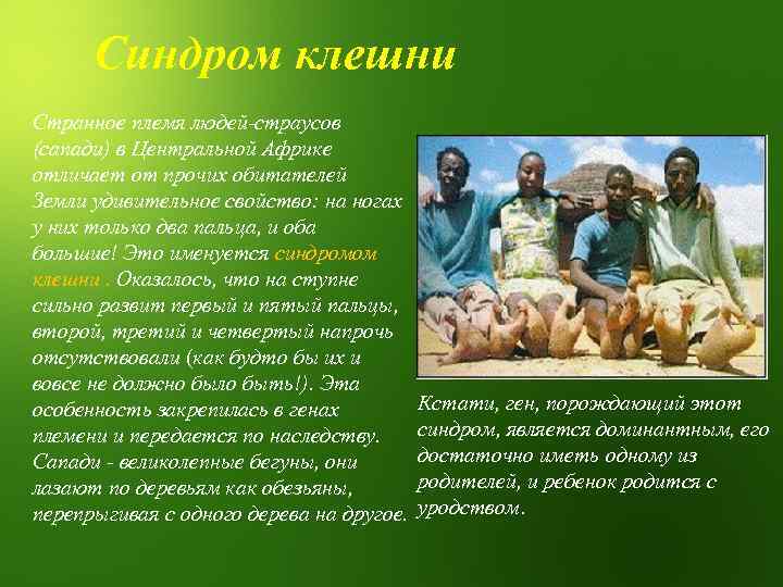 Синдром клешни Странное племя людей-страусов (сапади) в Центральной Африке отличает от прочих обитателей Земли