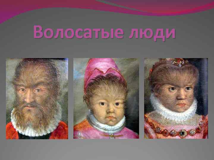 Волосатые люди 