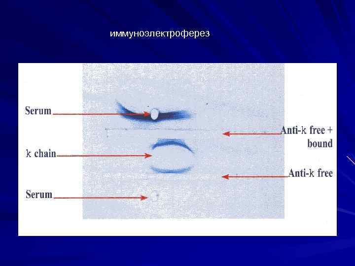 иммуноэлектроферез 