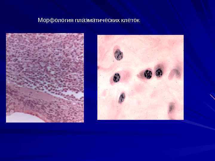 Морфология плазматических клеток 