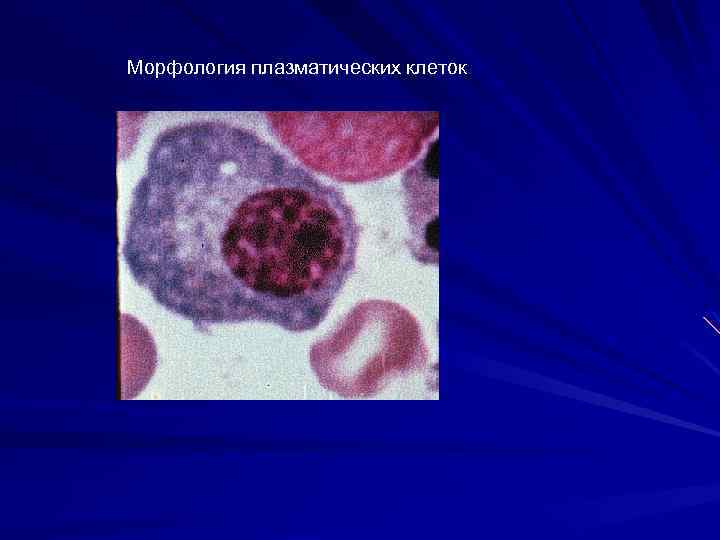 Морфология плазматических клеток 