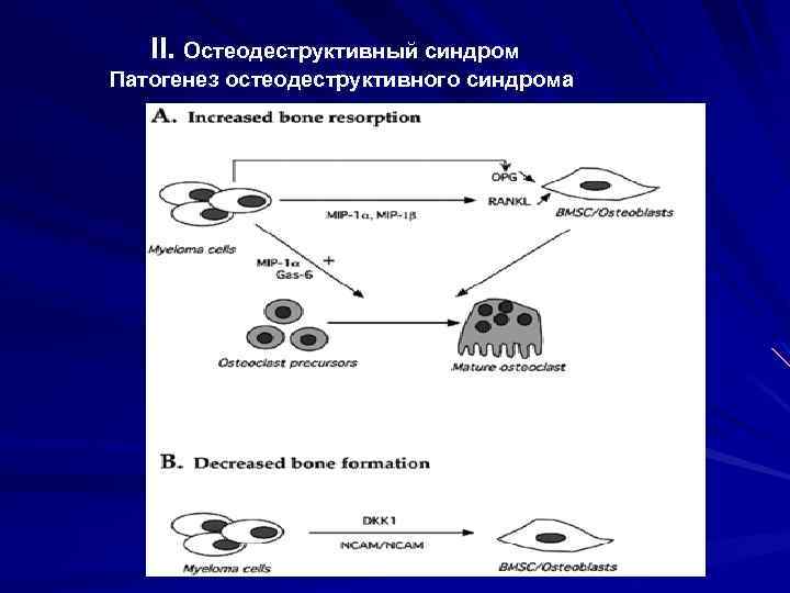 II. Остеодеструктивный синдром Патогенез остеодеструктивного синдрома 