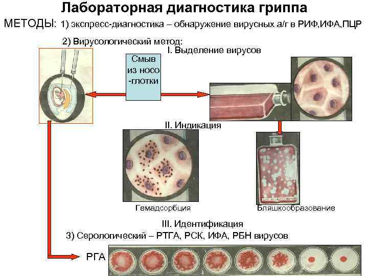 Лабораторная диагностика гриппа МЕТОДЫ: 1) экспресс-диагностика – обнаружение вирусных а/г в РИФ, ИФА, ПЦР