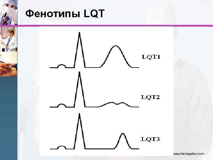 Удлинение интервала qt. Типы удлинения qt. Удлиненное qt симптомы. Фенотипы синдрома удлиненного интервала qt.