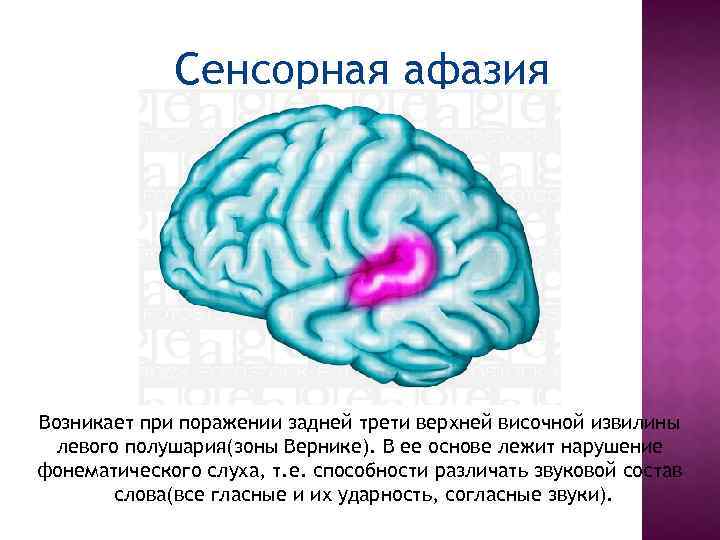 Сенсорная афазия. Сенсорная афазия очаг поражения. Очаг поражения при сенсорной афазии. При поражении зоны Вернике возникает афазия. Сенсорная афазия развивается при поражении:.