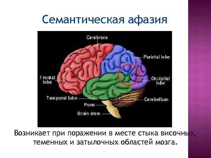 Семантическая афазия. Семантическая афазия очаг поражения. Семантическая афазия симптомы. Акустико семантическая афазия. Семантическая афазия зона поражения.