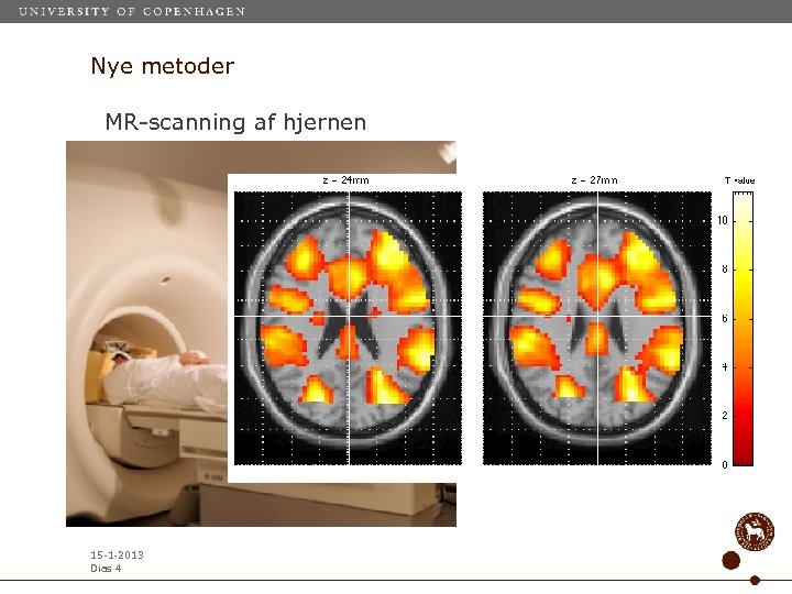 Nye metoder MR-scanning af hjernen 15 -1 -2013 Dias 4 