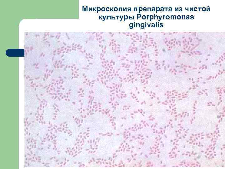 Микроскопия препарата из чистой культуры Porphyromonas gingivalis 