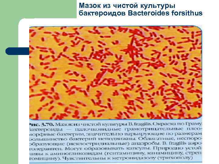 Мазок из чистой культуры бактероидов Вacteroides forsithus 