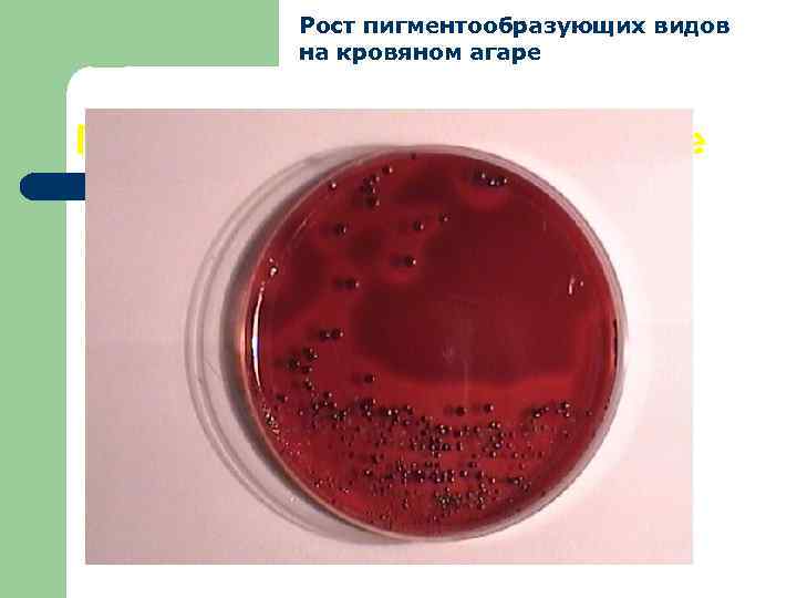 Рост пигментообразующих видов на кровяном агаре Превотеллы на кровяном агаре 