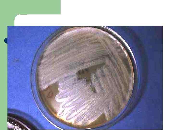 Фузобактерии на селективной среде 