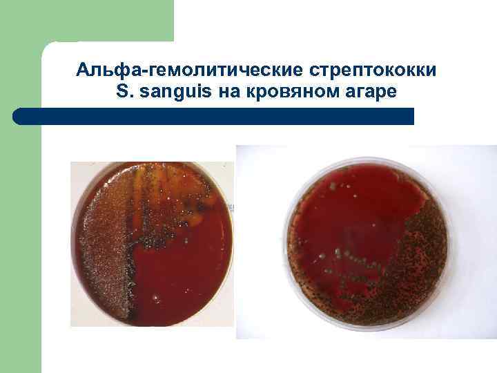 Альфа-гемолитические стрептококки S. sanguis на кровяном агаре 