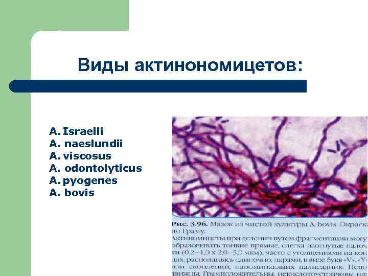 Виды актинономицетов: A. Israelii A. naeslundii A. viscosus A. odontolyticus A. pyogenes A. bovis