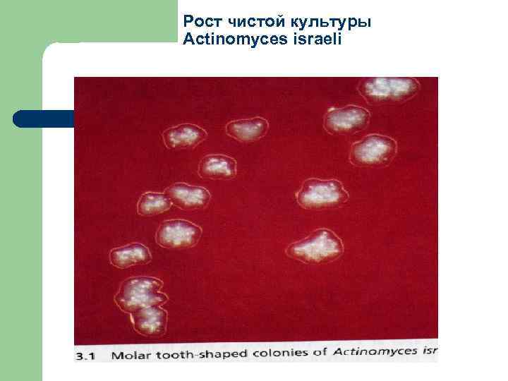 Рост чистой культуры Actinomyces israeli 
