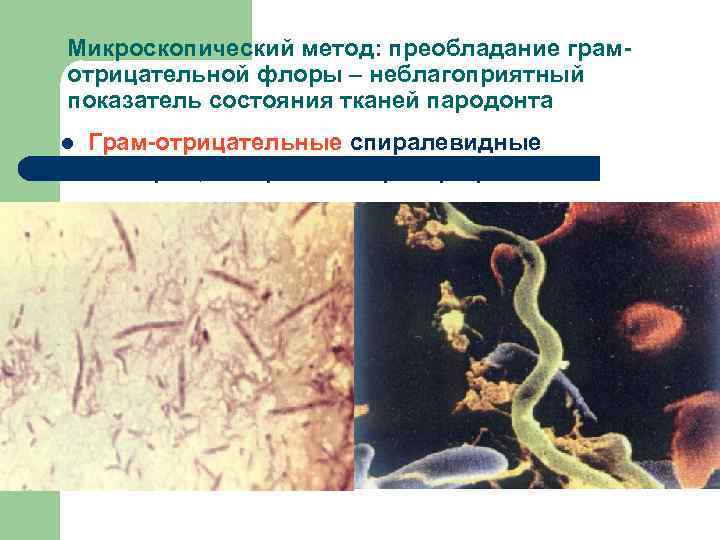 Микроскопический метод: преобладание грамотрицательной флоры – неблагоприятный показатель состояния тканей пародонта l Грам-отрицательные спиралевидные
