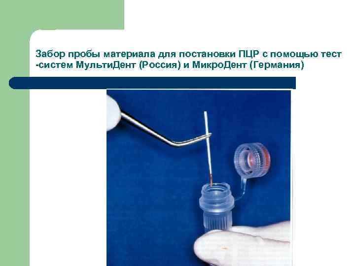 Забор пробы материала для постановки ПЦР с помощью тест -систем Мульти. Дент (Россия) и