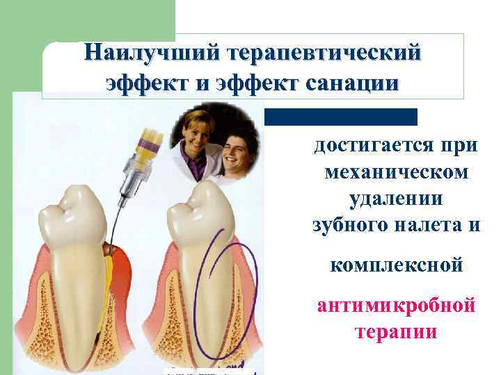 Наилучший терапевтический эффект и эффект санации достигается при механическом удалении зубного налета и комплексной