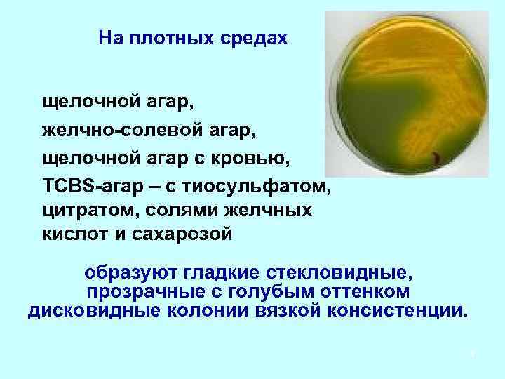 Вода плотная среда. Щелочной агар питательная среда. Холерный вибрион на питательных средах. Питательная среда для выделения холерного вибриона. Плотные питательные среды.